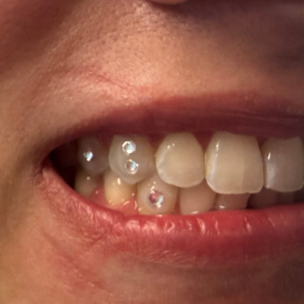 Tooth Gem Special Design at Alyssa Rene Esthetics in Lewiston, ID