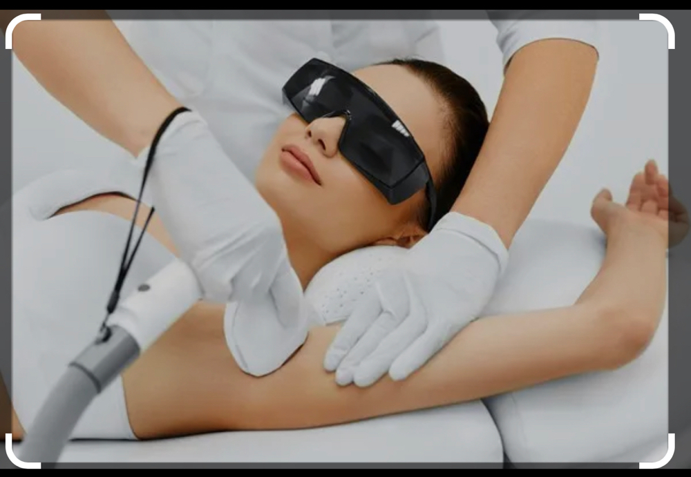 Laser Hair Removal