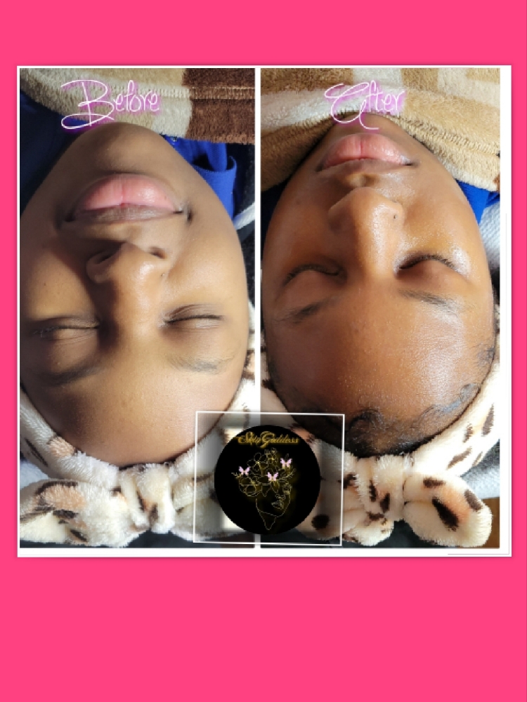 Facials