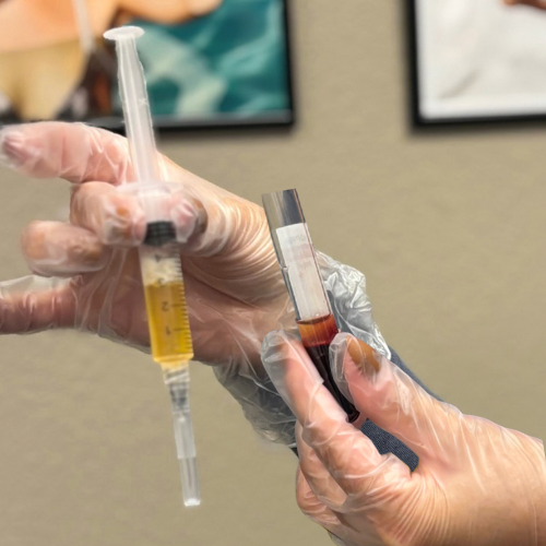 PRF Microneedling at Viv Aesthetics & Wellness in San Antonio, TX