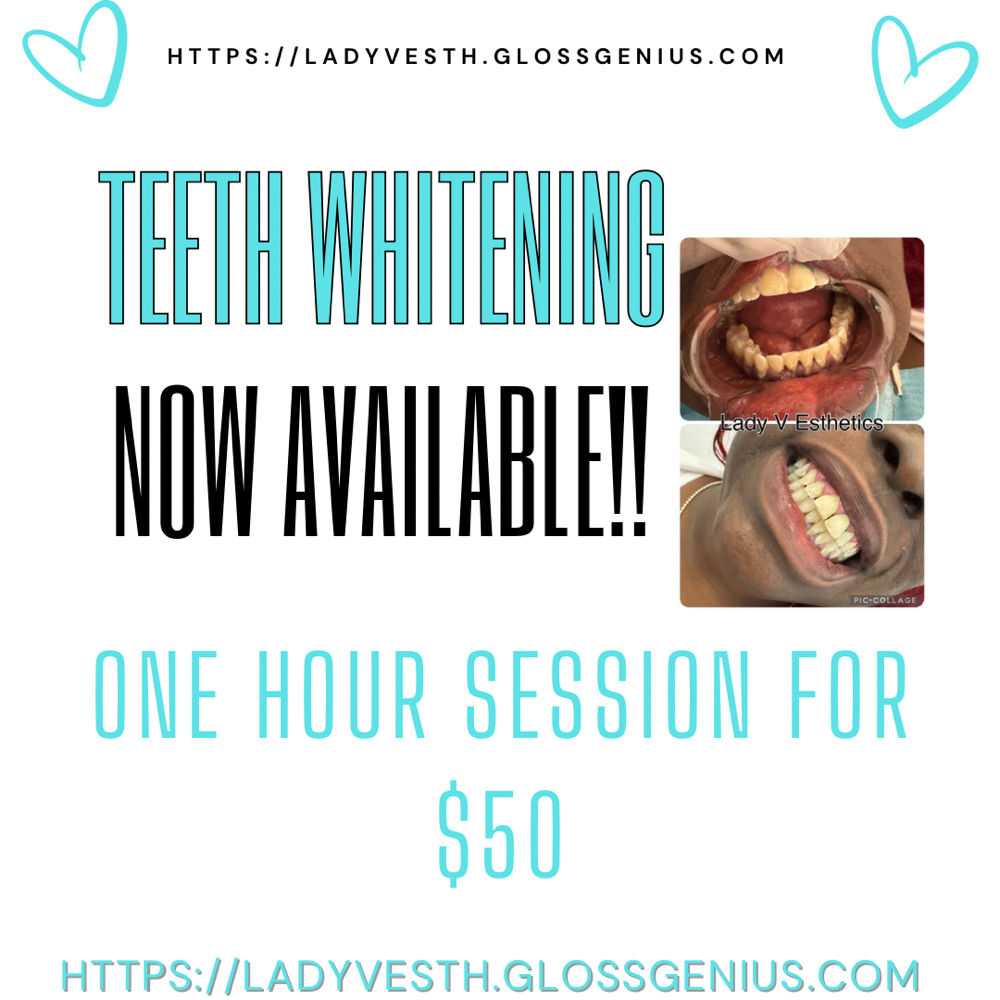 Teeth Whitening
