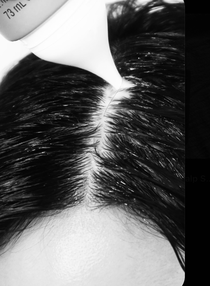 Scalp Detox