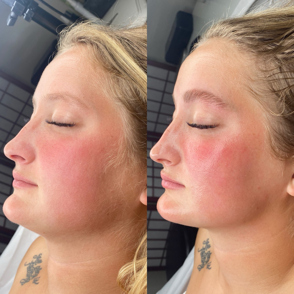 'Purrfect Primer Dermaplane' Facial