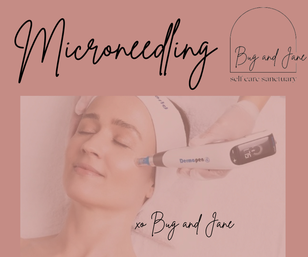 Microneedling (PACKAGE)