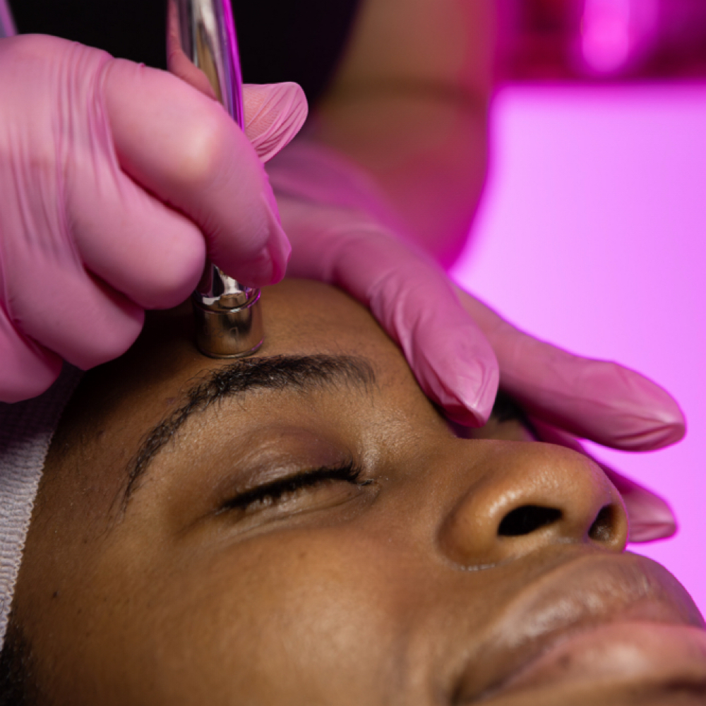 Diamond Microdermabrasion Facial at Maryna Skin Studio in Chicago, IL