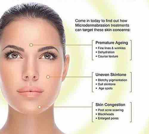 Microdermabrasion Add On