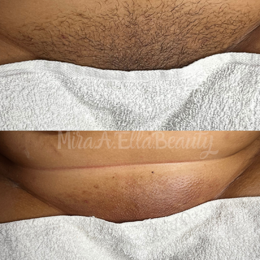 Brazillian Wax at JA Beauty & Skin in Kansas City, MO