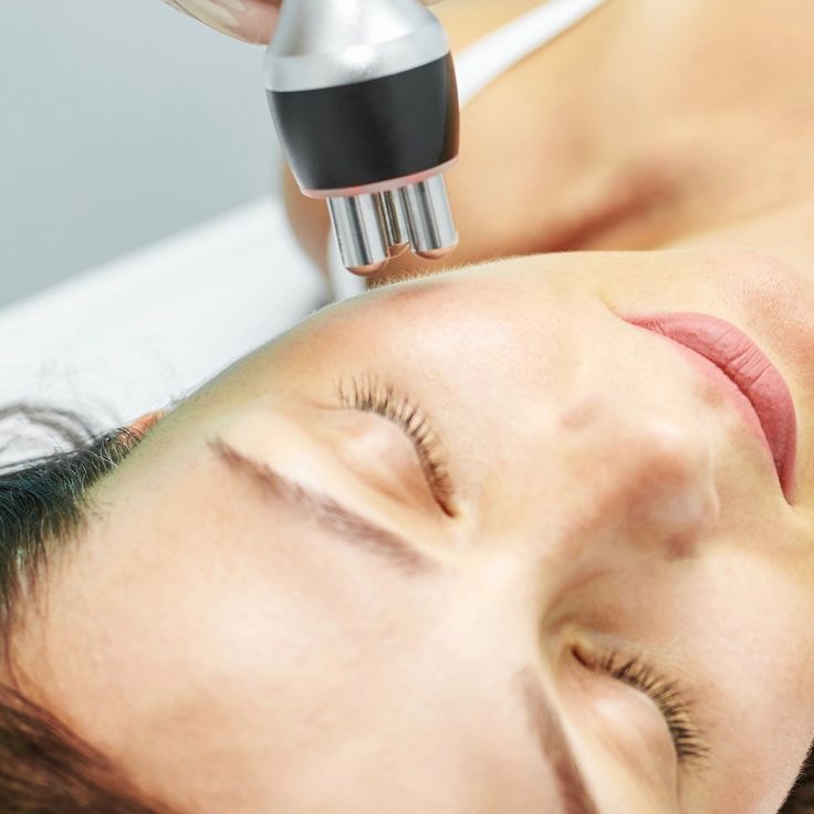 Radio Fequency Facial