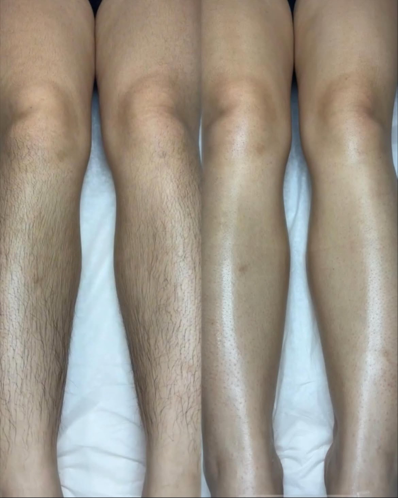 Full Leg Wax