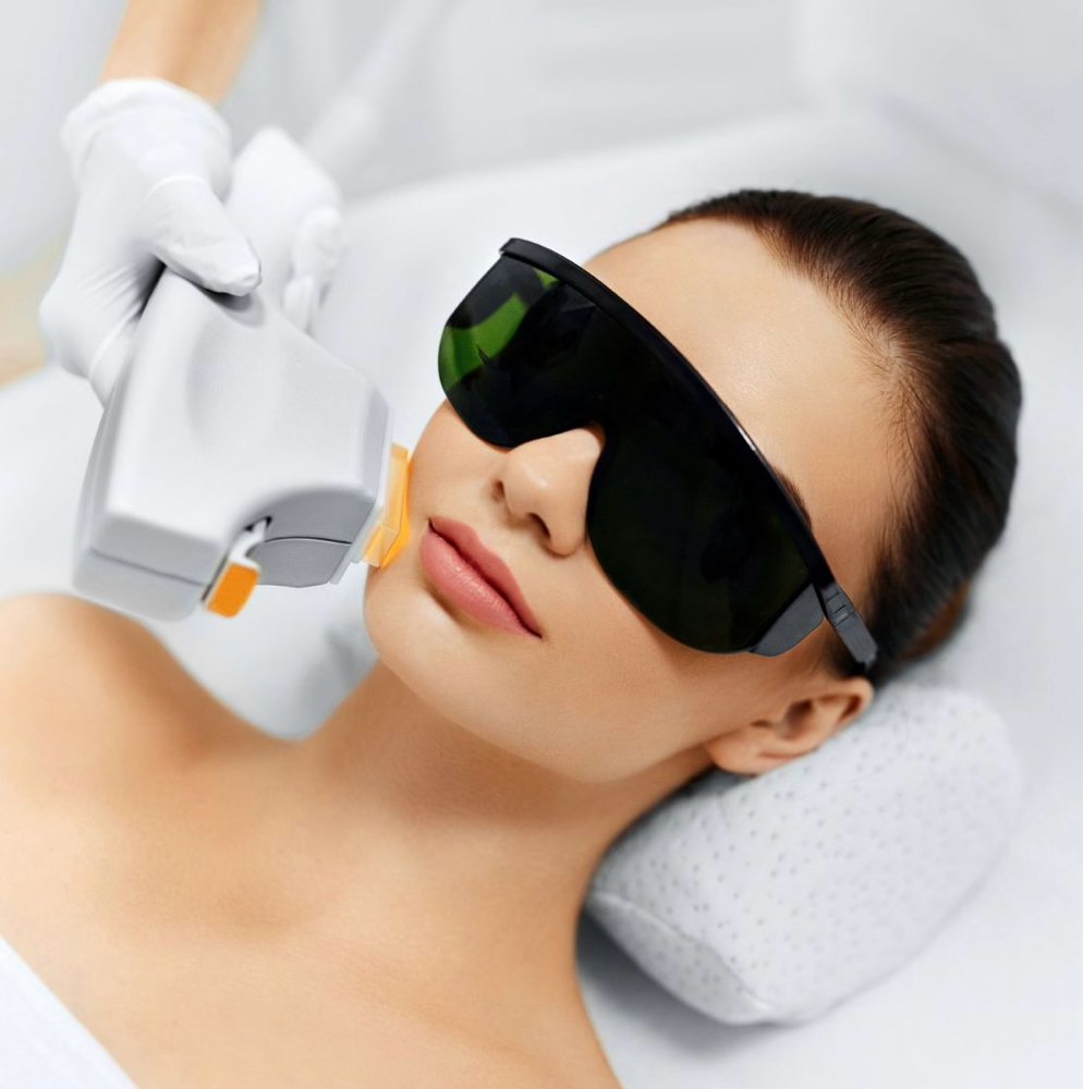 Photo Facial