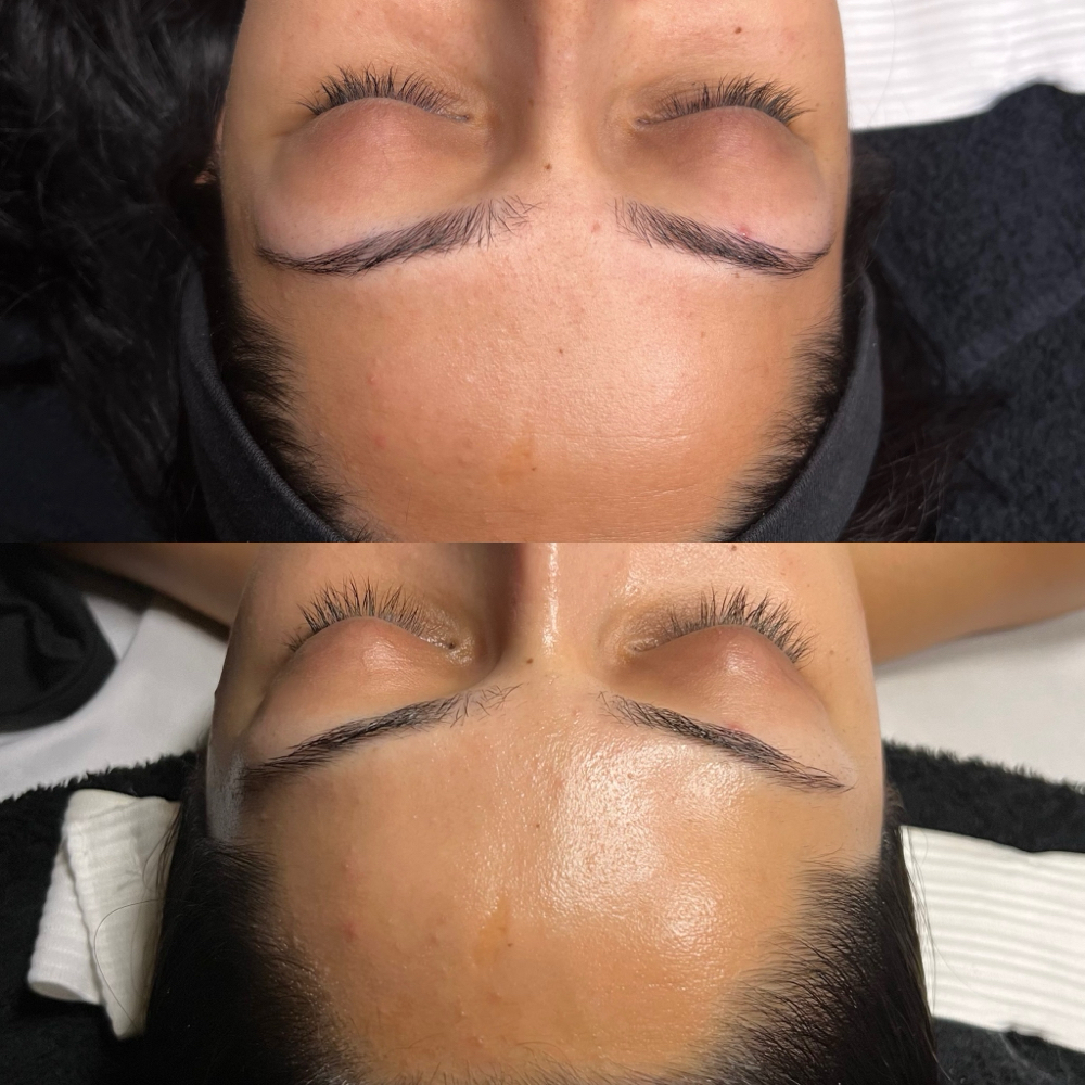 The Hydro-Glow Facial