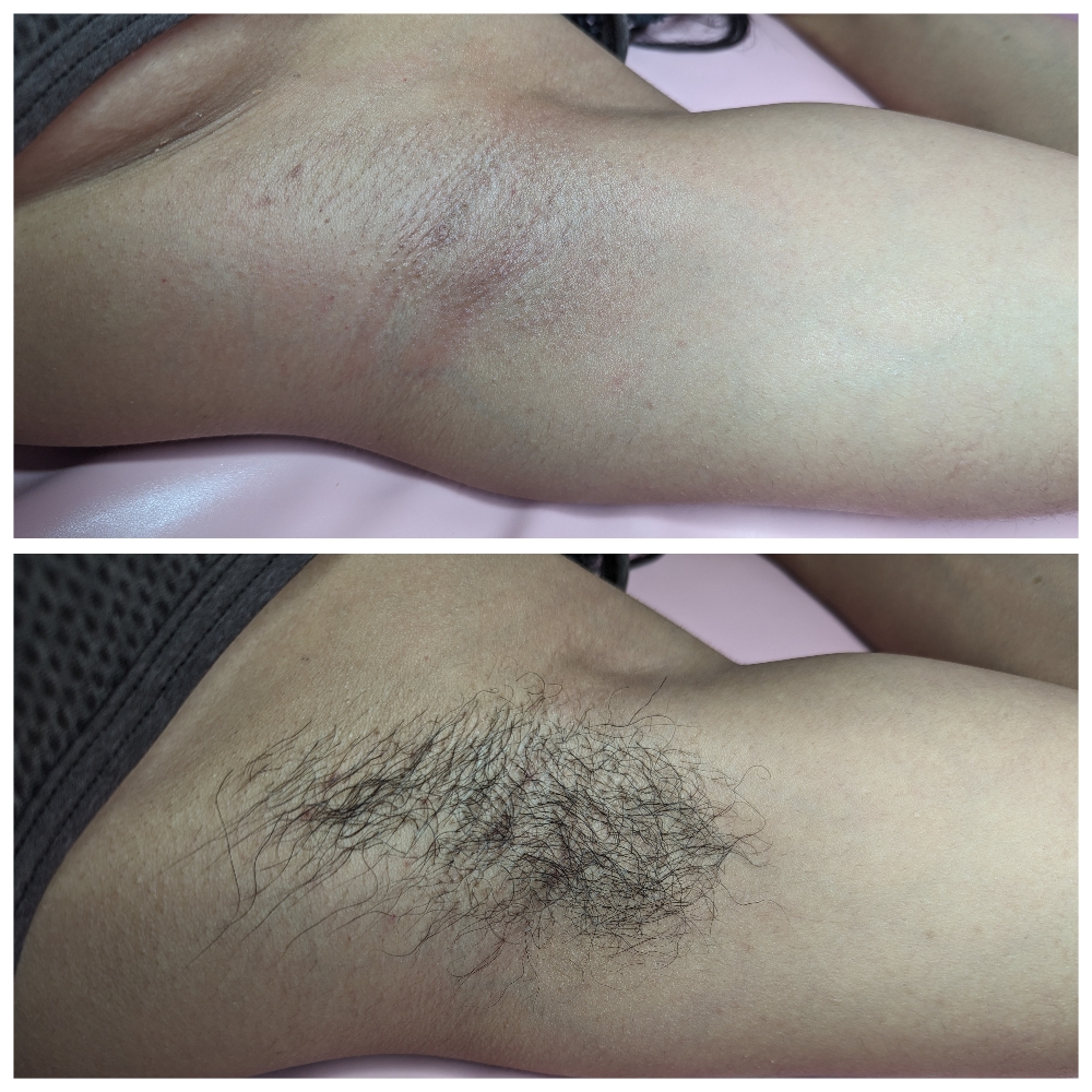 Underarm Wax