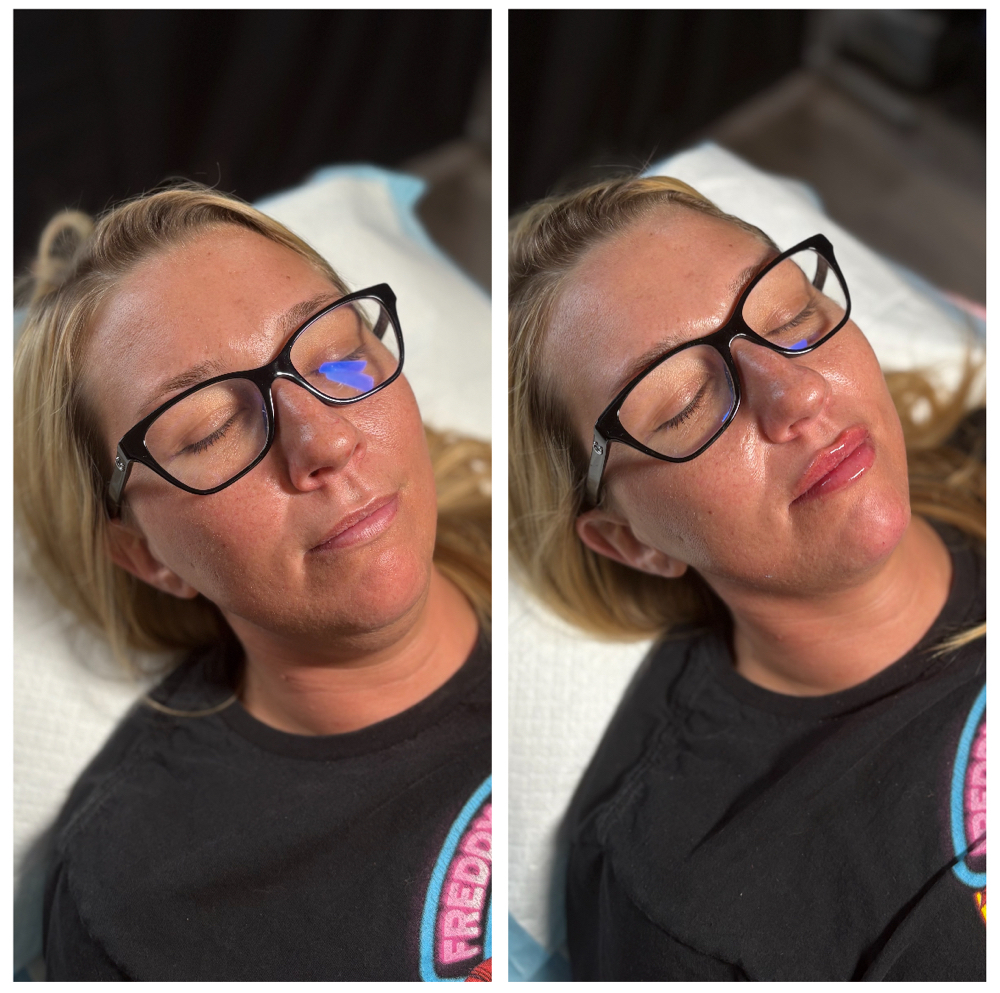 Facial Balance Session