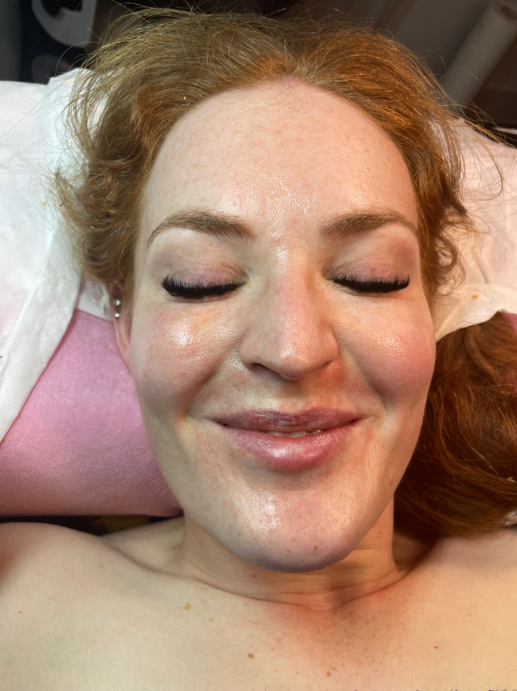 Upper Lip And Chin Threading