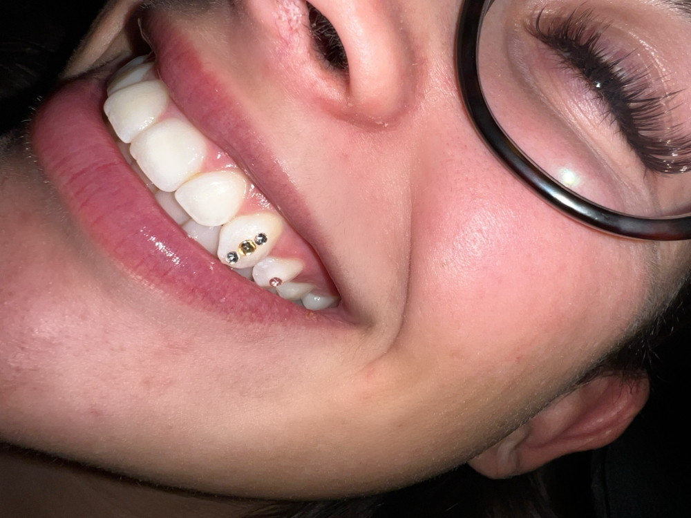 Tooth Gems