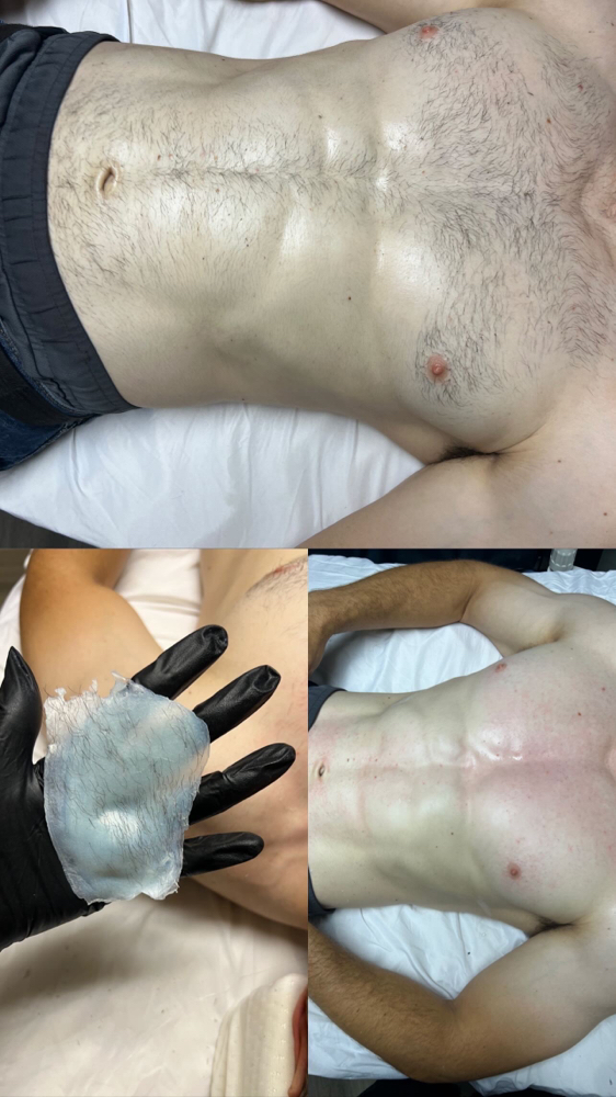 Mens Chest Wax