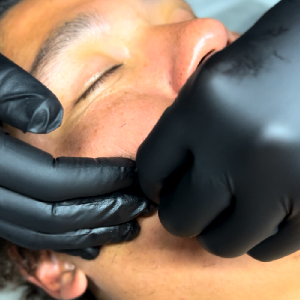 Transformative Facial w Buccal at The Skin Co. in Orange, CA