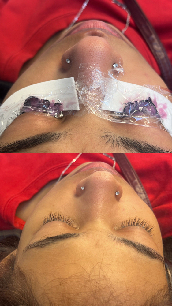 Lash Removal