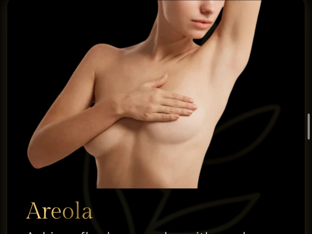 Areola