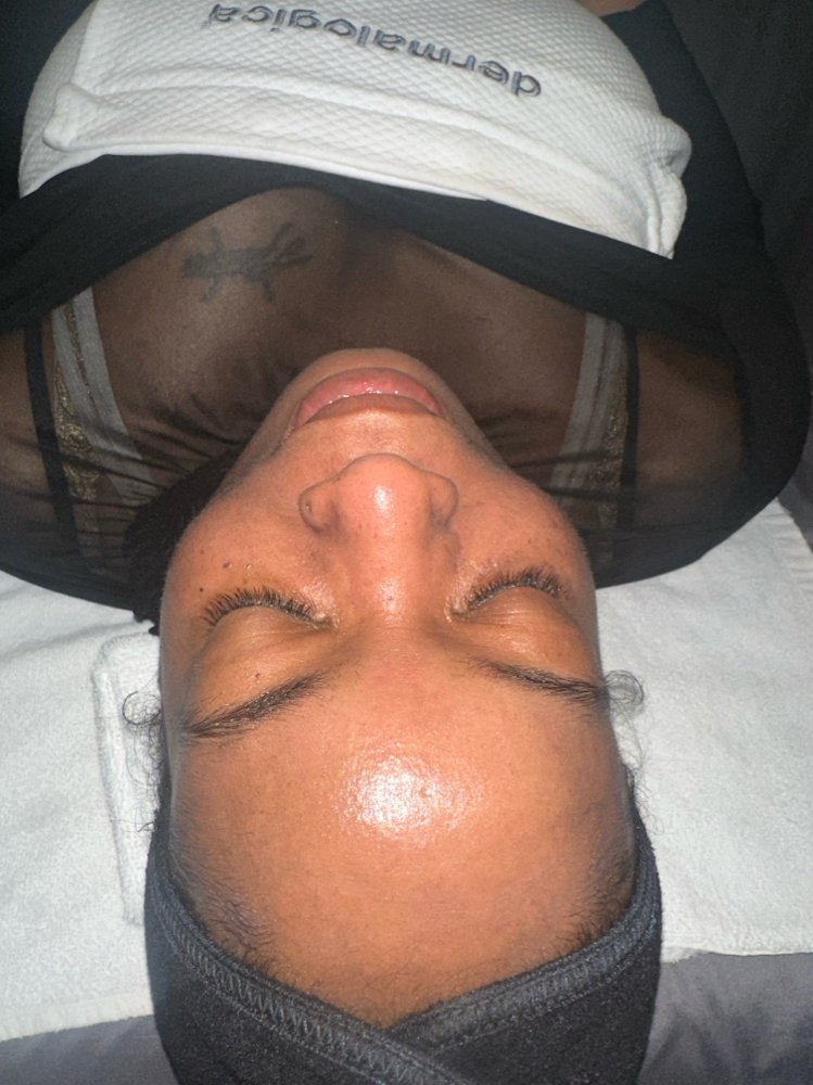 PCA Signature Facial