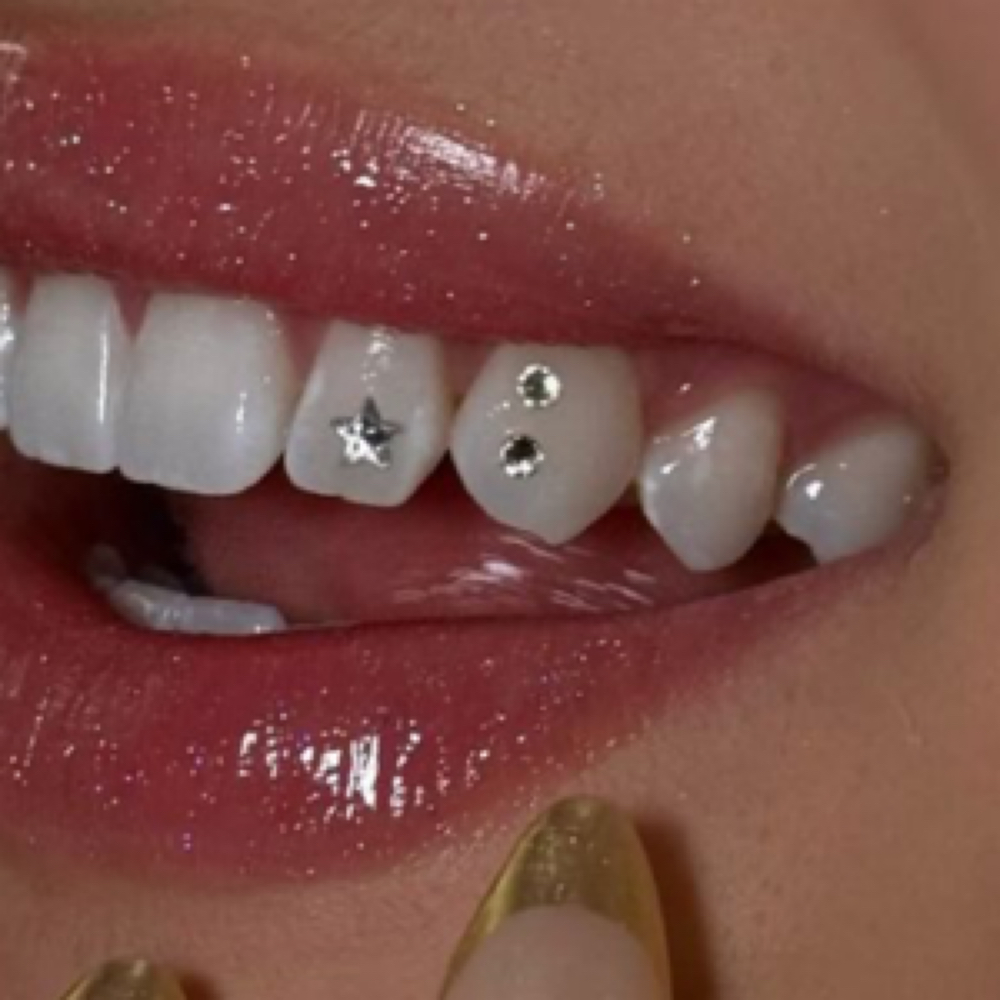 Tooth Gems