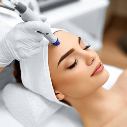 Nanoneedling — Full Face at Soluna Vee Spa in Colorado Springs, CO