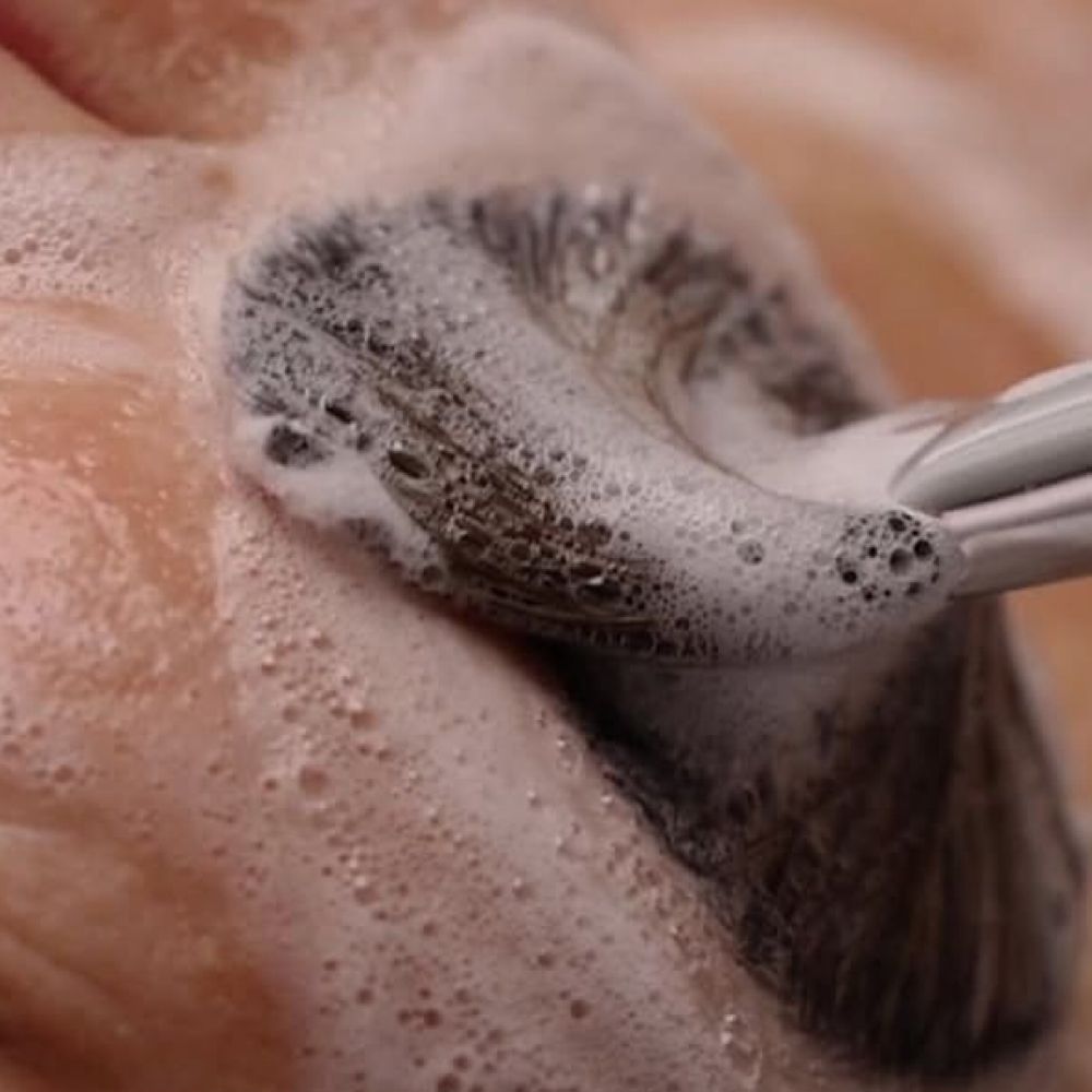 Microderm Treatment at MySkin Aesthetics in Laredo, TX