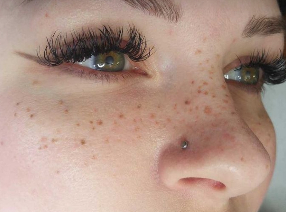 Tattoo Freckles
