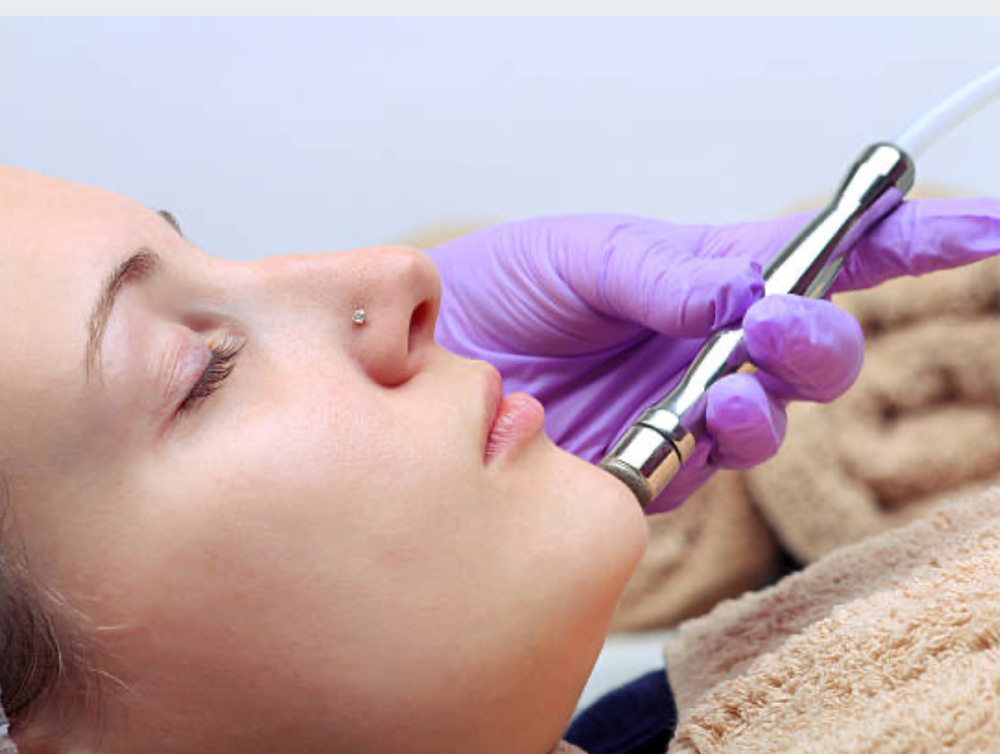 EXECUTIVE MICRODERMABRASION SESSION