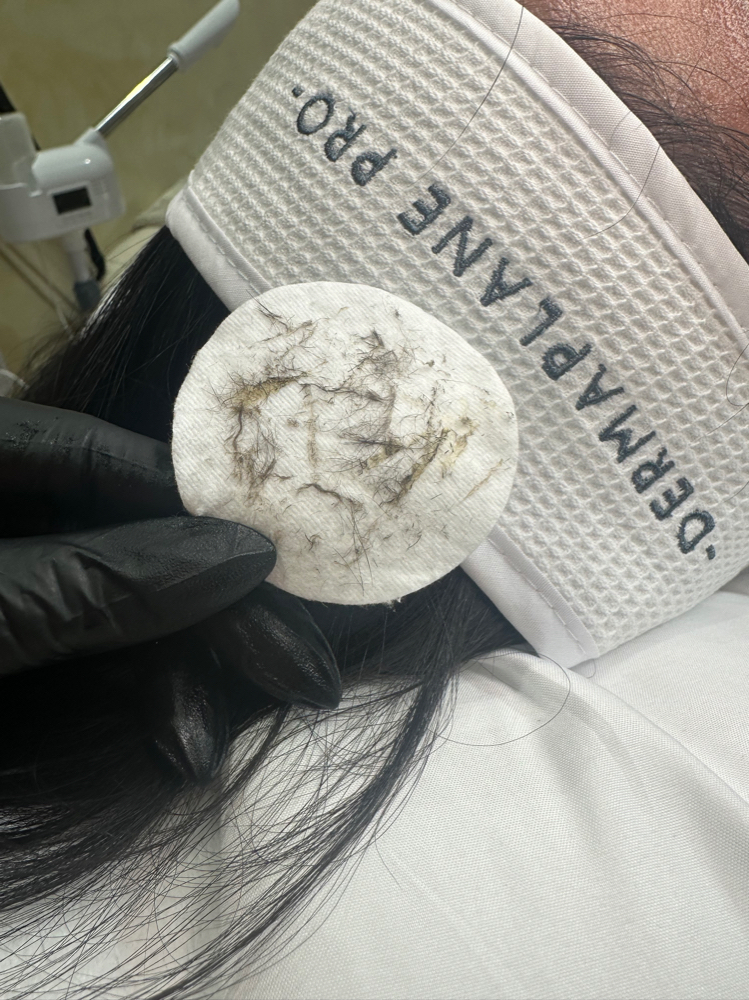 Dermaplane Facial