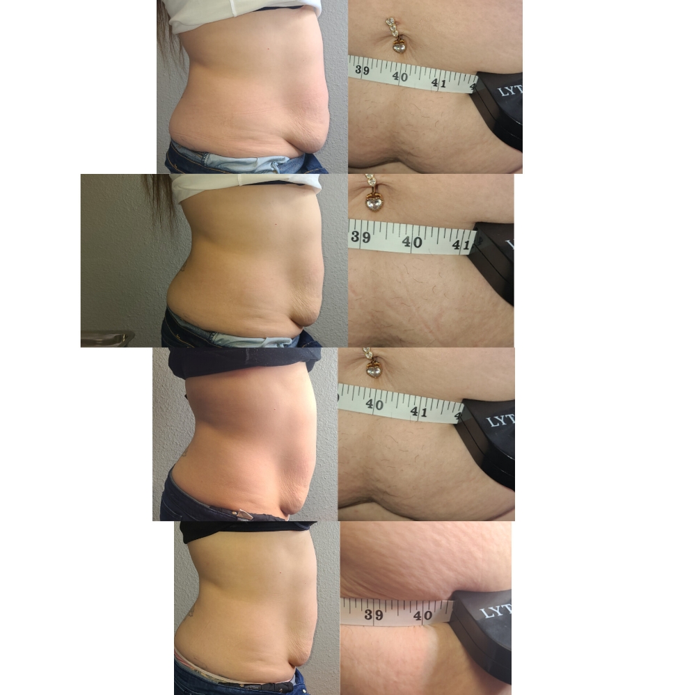 2area 3sessions 1hour Each