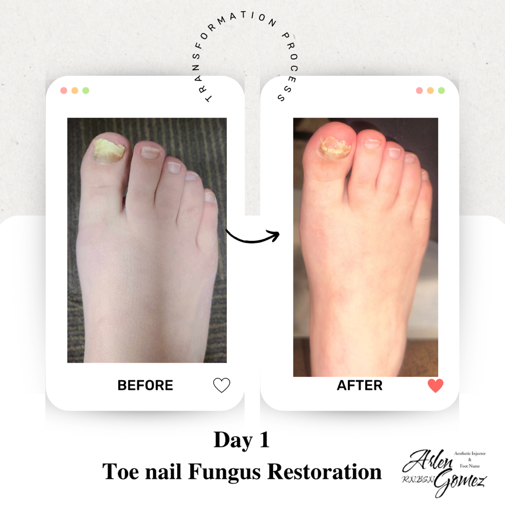 Toenail & Skin Restoration