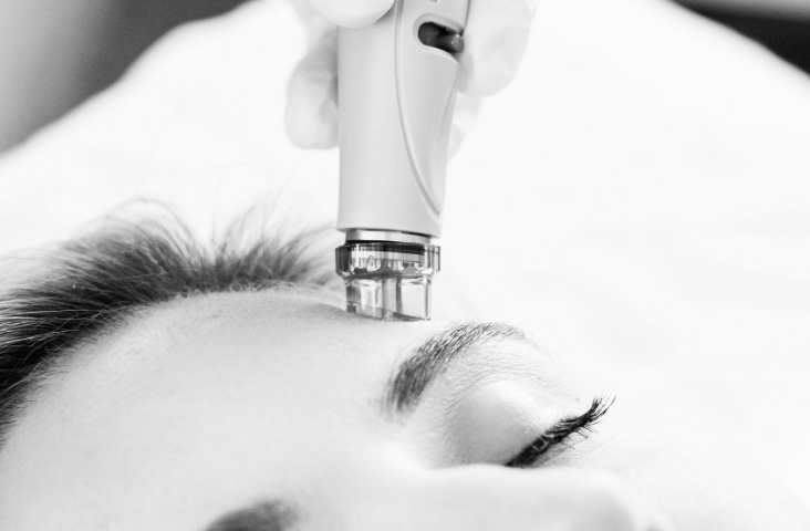 H2O HydroDermabrasion Facial