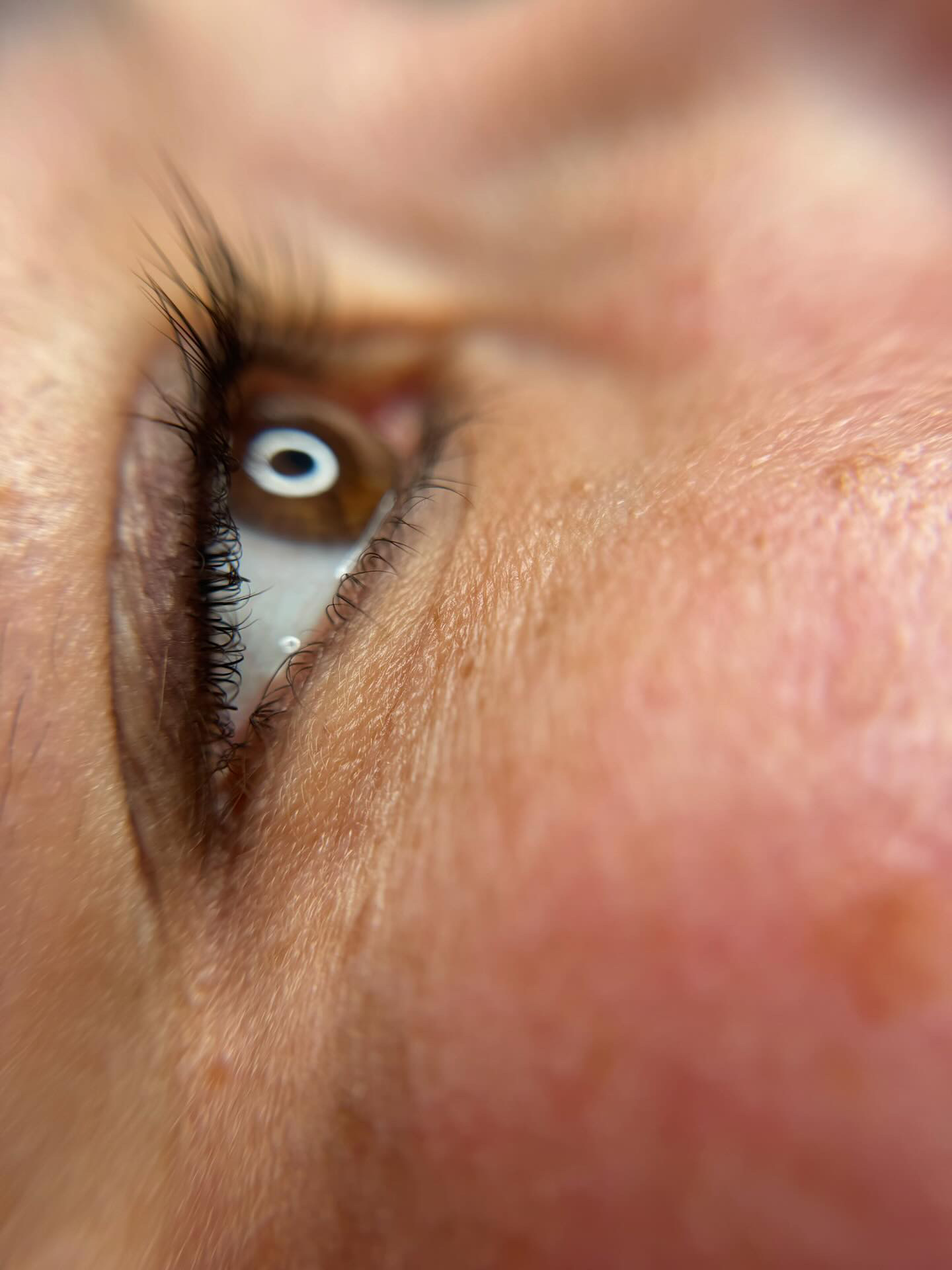 Eye Lash Enhancement
