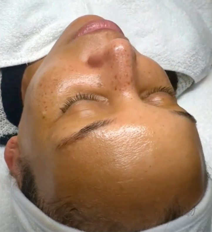 Advance Renewal Peel