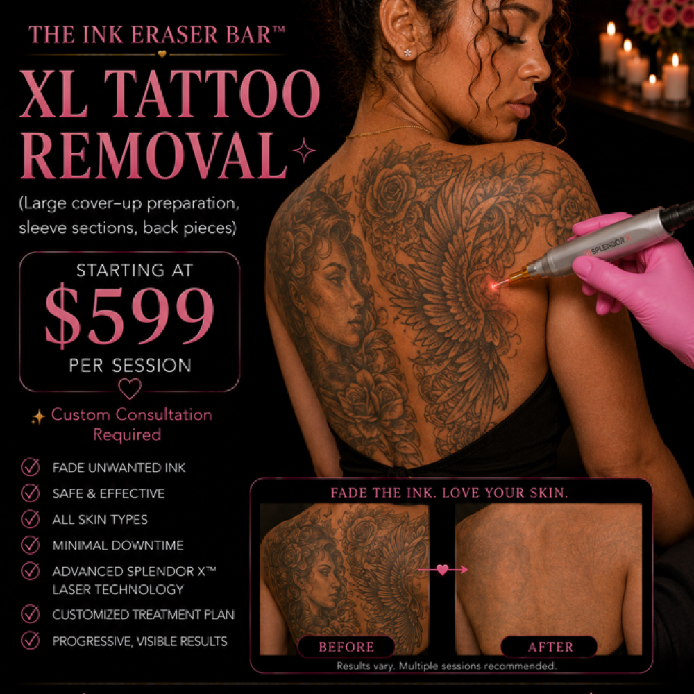 XL Tattoo Removal at Silk Society Beauty Bar in Houston, TX