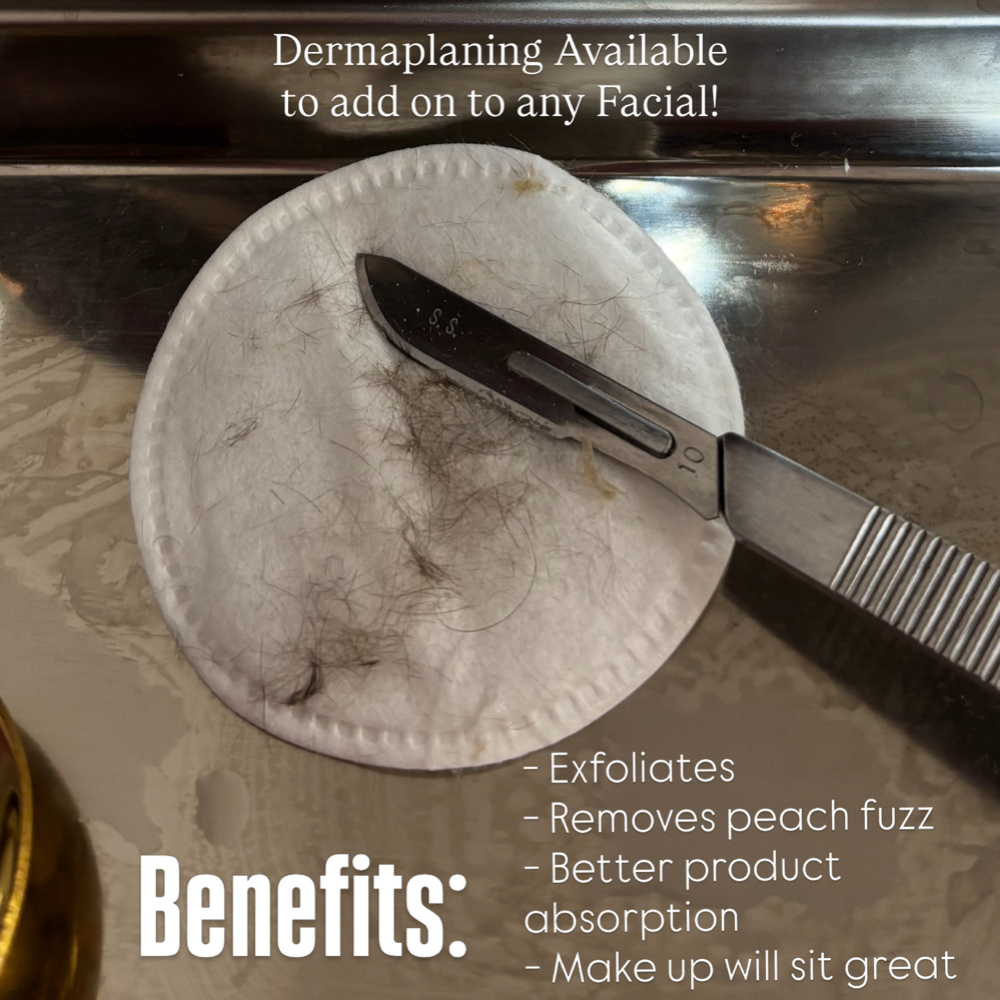 Dermaplane at Sandra the Esti LLC in Downers Grove, IL