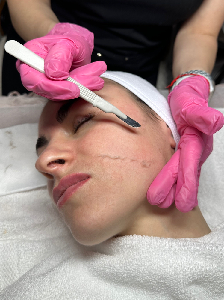 Dermaplaning Facial