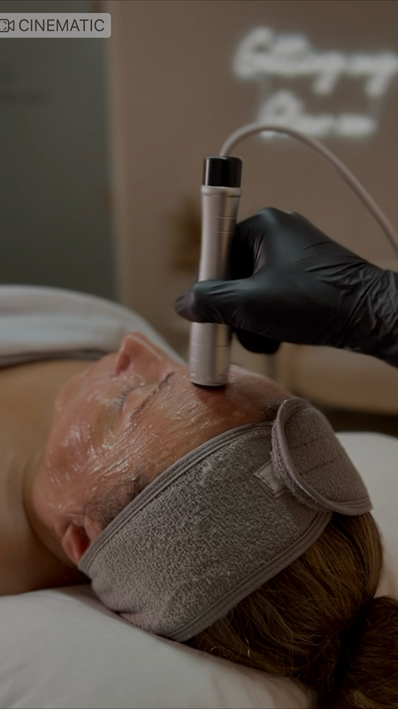 Radio Frequency - Skin Tightening