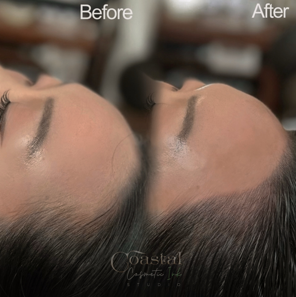 Permanent Hairline Density at Coastal Cosmetic Ink in Pass Christian, MS