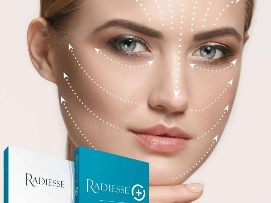 Radiesse