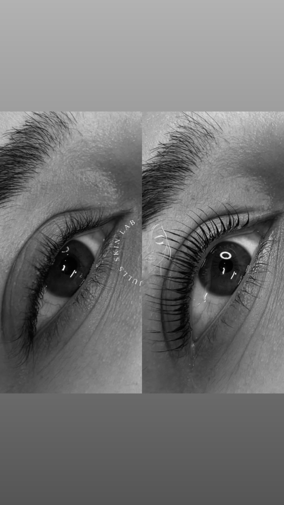 LASH LIFT