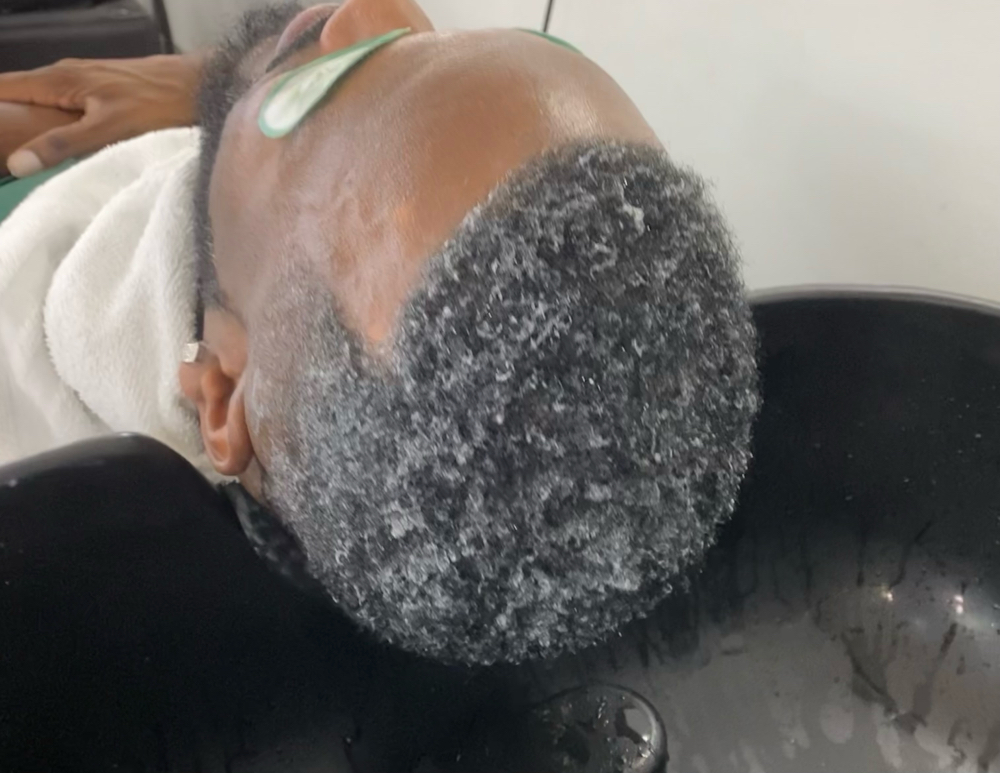 Root Exfoliation at Rooted Wellness Institute in Forest Park, GA