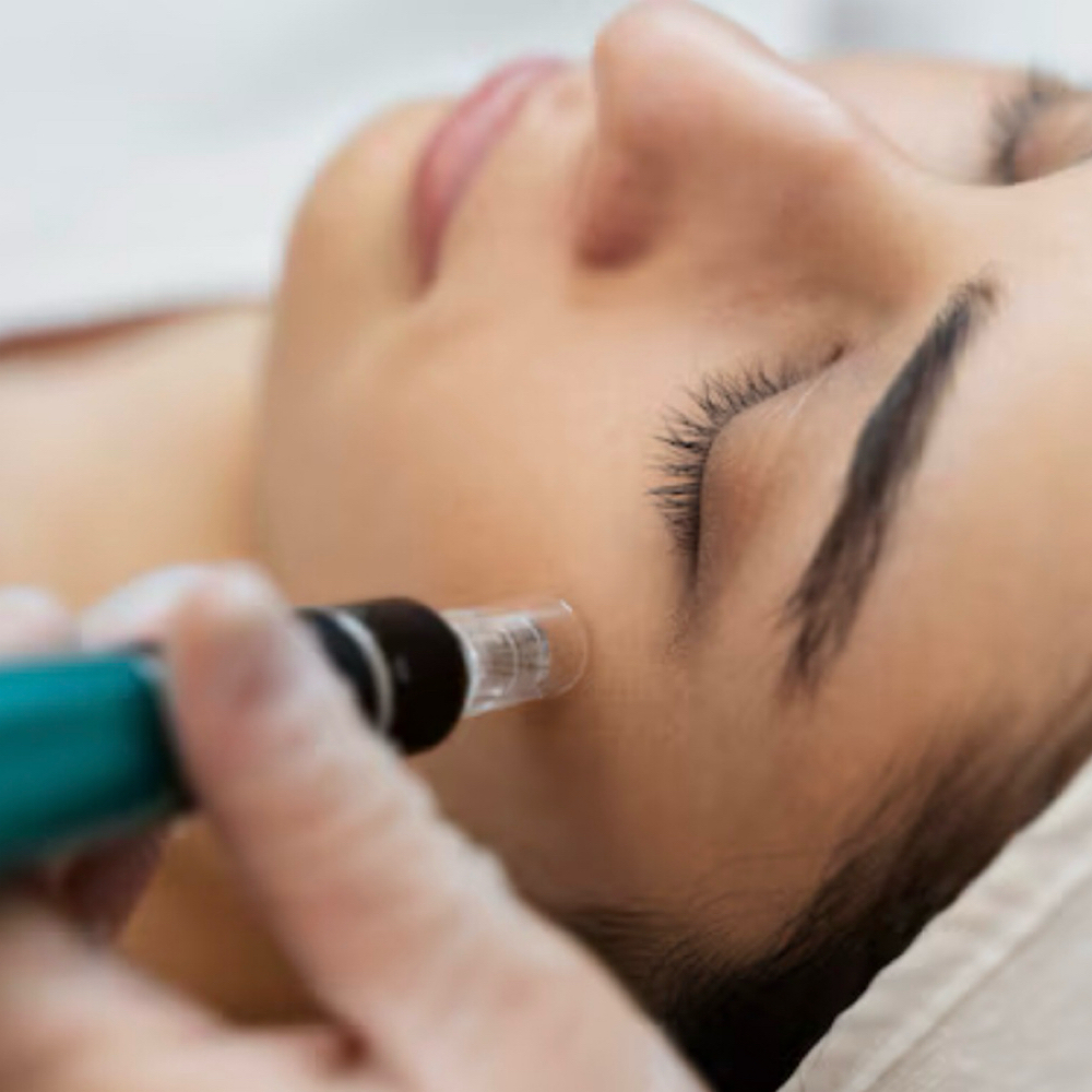 Nano Needle Add On at Skin Ritual Studio in San Antonio, TX
