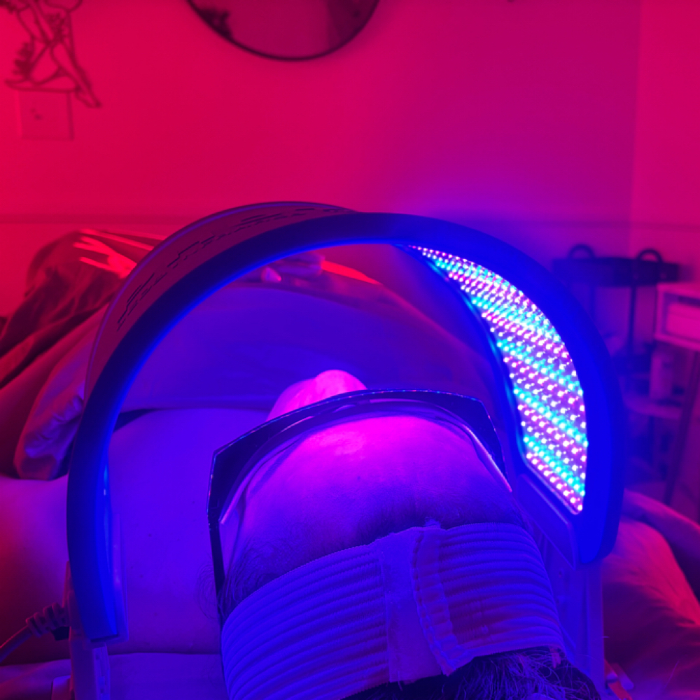 Acne Facial at Gleam Glitz Glow in Las Vegas, NV