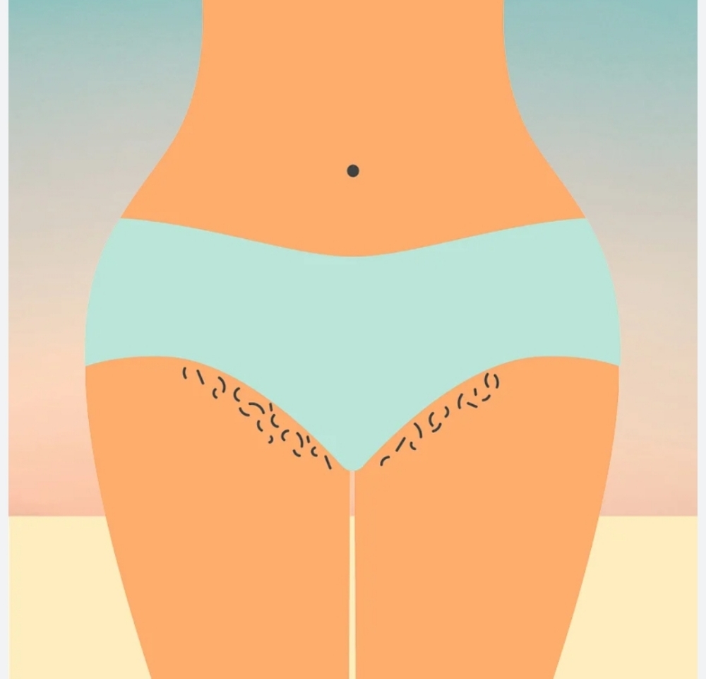 Bikini Wax at Lux Aesthetics in Rockford, IL