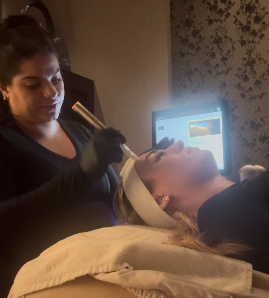 Microneedling at Beauty By Ruvi in Miami Gardens, FL