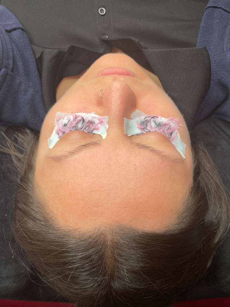 Lash Removal