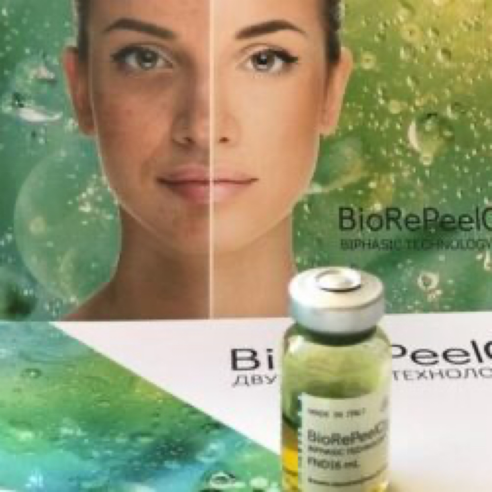 BioRePeel at Aesthetics by Alli in Eagle, ID
