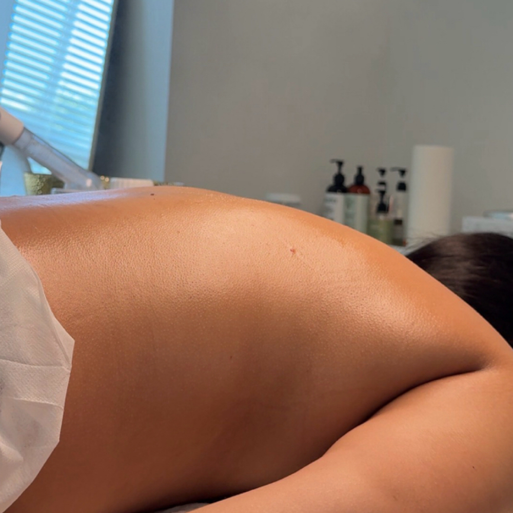 BACK FACIAL at BYLISETTA in Vista, CA